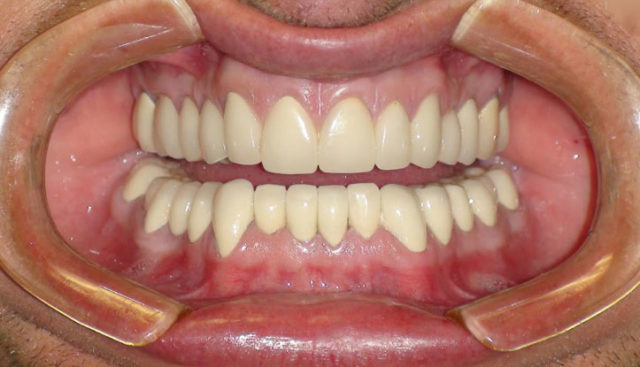 metody-gigieny-polosti-rta