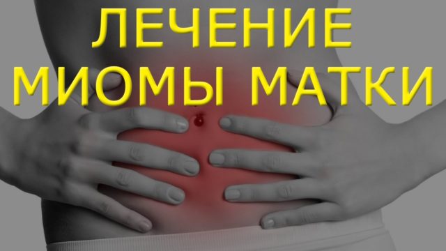 миома матки во время беременности