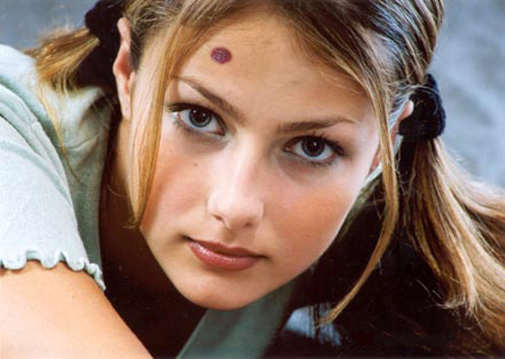 родинка на лбу