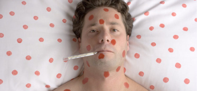 симптомы кори у взрослых