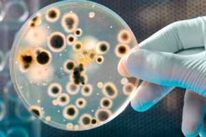 трихомониаз симптомы