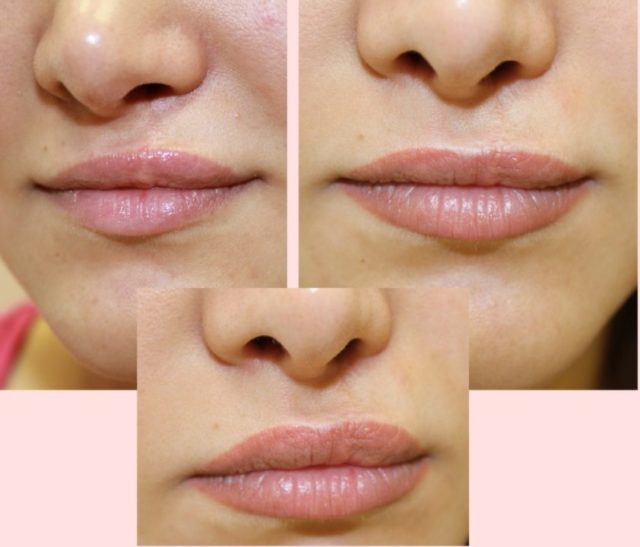 zajach'ja-guba-prichiny