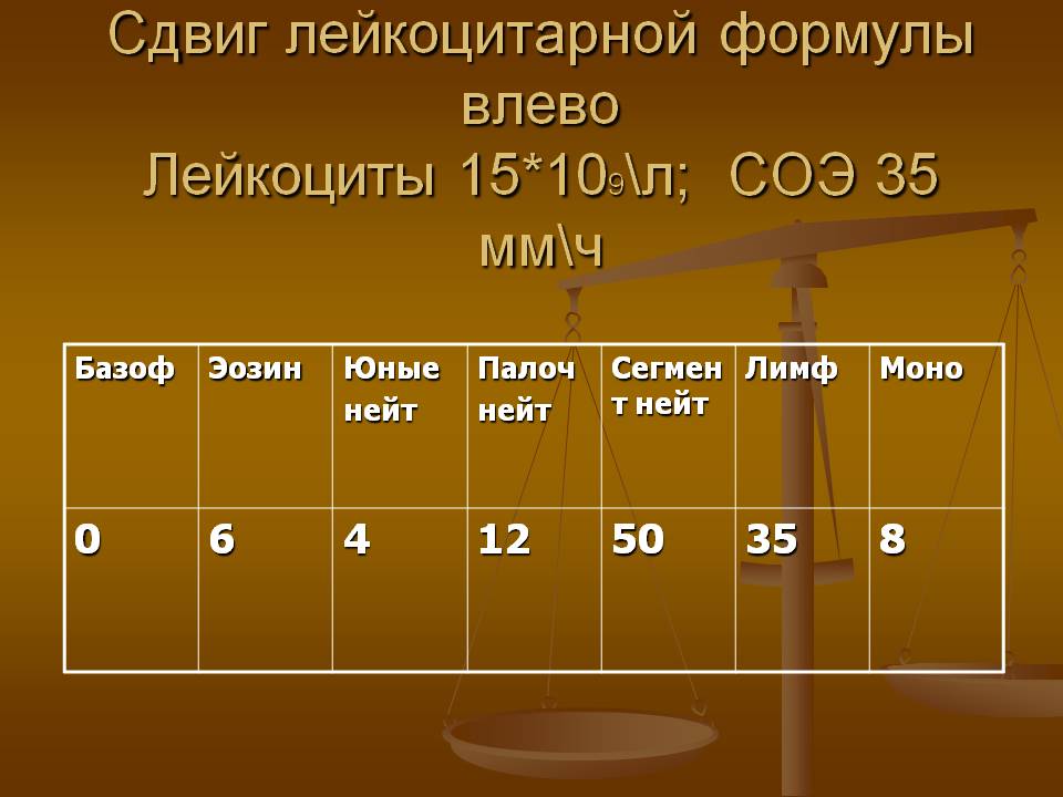 Сдвиг лейкоцитарной формулы влево