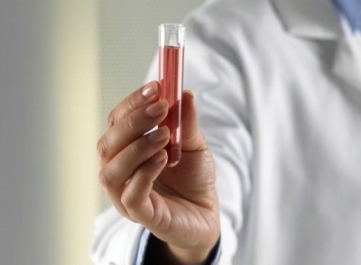 анализ крови