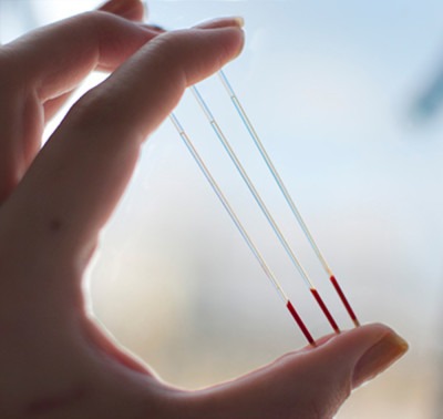 гематокрит