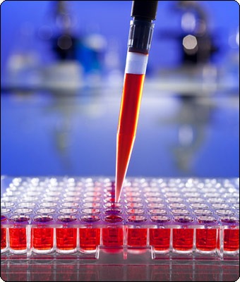 цветной показатель крови