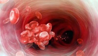 густая кровь