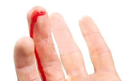 кровотечения