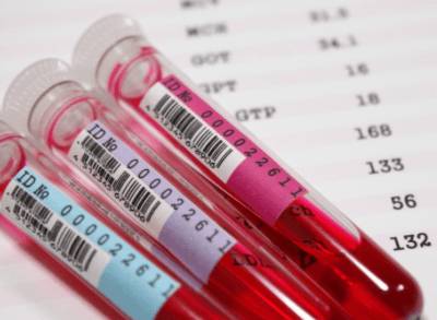 тромбоцитоз анализ