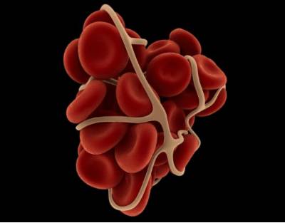 агрегация тромбоцитов