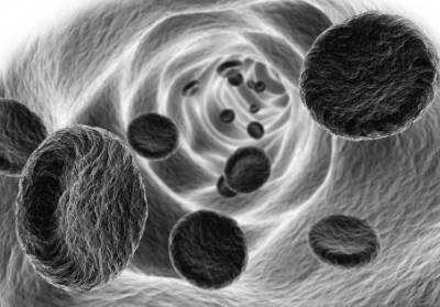 Гиперагрегация тромбоцитов