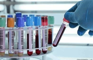 индуцированной агрегации тромбоцитов