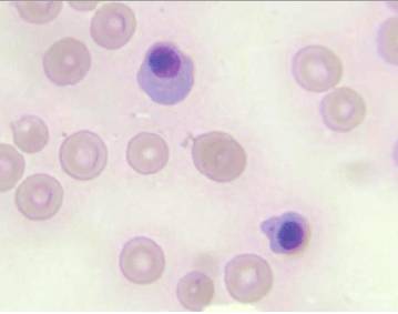 Эритропения