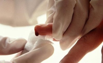 анализ крови на лимфоциты