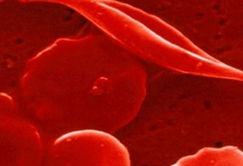 Эритроцитоз