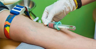 кровь из вены