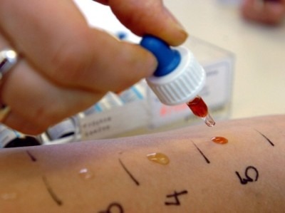 diagnostika_allergicheskih_zabolevanij_525_645