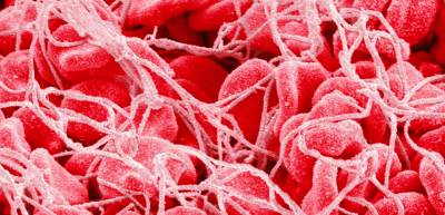 тромбоцитоз