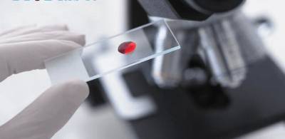 кровь в анализе