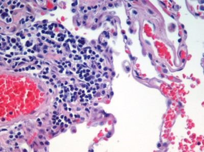 базофилы повышены