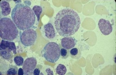 ретикулоцит