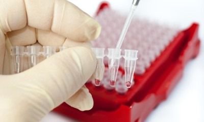 натрий в крови