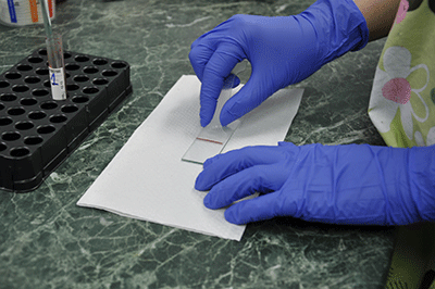 мазок крови на стекле