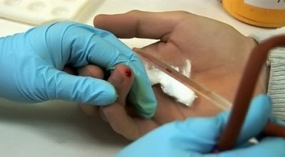 общий анализ крови