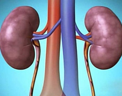Почечная дисфункция