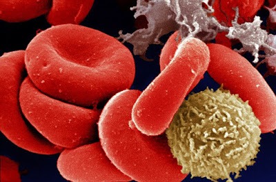 лейкоцитоз