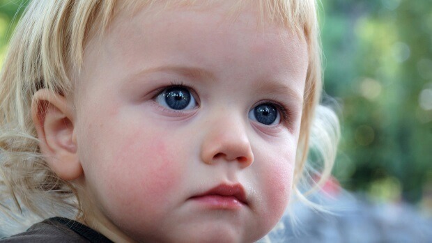 Красные пятна у ребенка